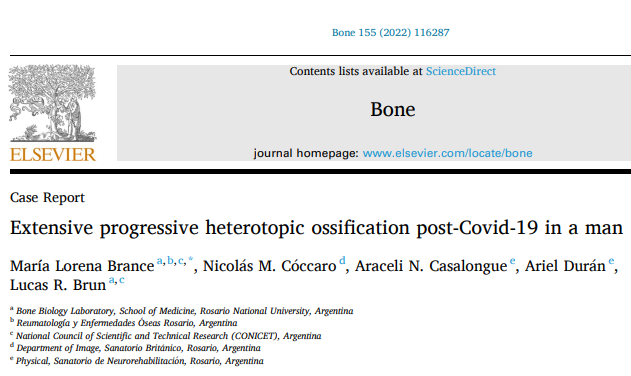 Extensive progressive heterotopic ossification post-Covid-19 in a man